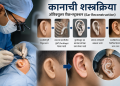 आधुनिक शस्त्रक्रियेमुळे कानाच्या विकृतीवर मात; पैठणच्या तरुणाला मिळाला नव्या आयुष्याचा आत्मविश्वास